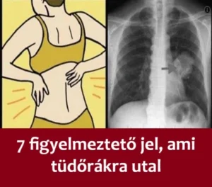 7-figyelmezteto-jel-ami-tudorakra-utal