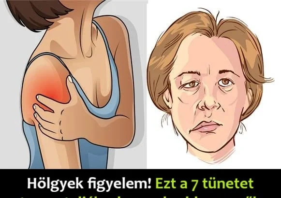 Holgyek-leggyakrabban-a-nok-stroke-soran
