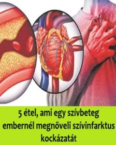 5-etel-ami-egy-szivbeteg-embernel-megnoveli-szivinfarktus-kockazatat