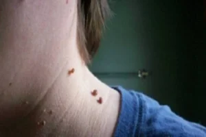 70950_skin