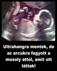Ultrahangra-mentek-de-az-arcukra-fagyott-a-mosoly-attol-amit-ott-lattak