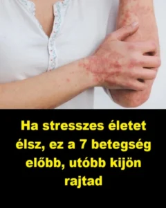 Ha-stresszes-eletet-elsz-ez-a-7-betegseg-elobb-utobb-kijon-rajtad