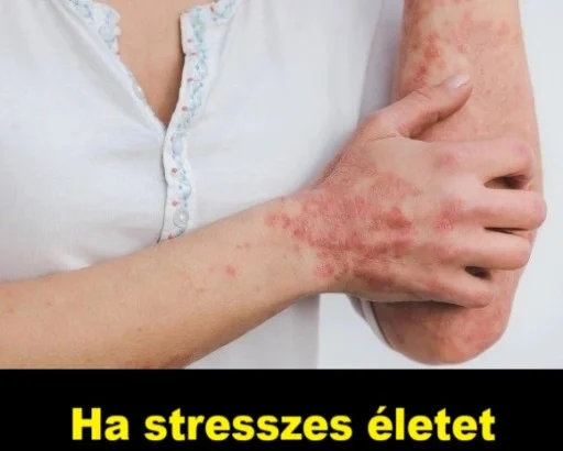 Ha-stresszes-eletet-elsz-ez-a-7-betegseg-elobb-utobb-kijon-rajtad